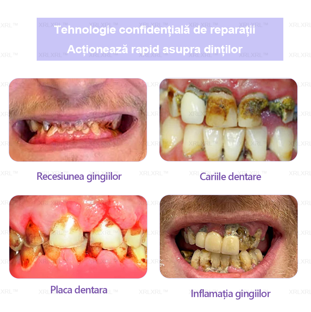 XRLXRL™ Praf Mineral pentru Restaurarea Dentară - Recomandat de ADA (🦷Reducere limitată, mai rămân 30 de minute🦷)