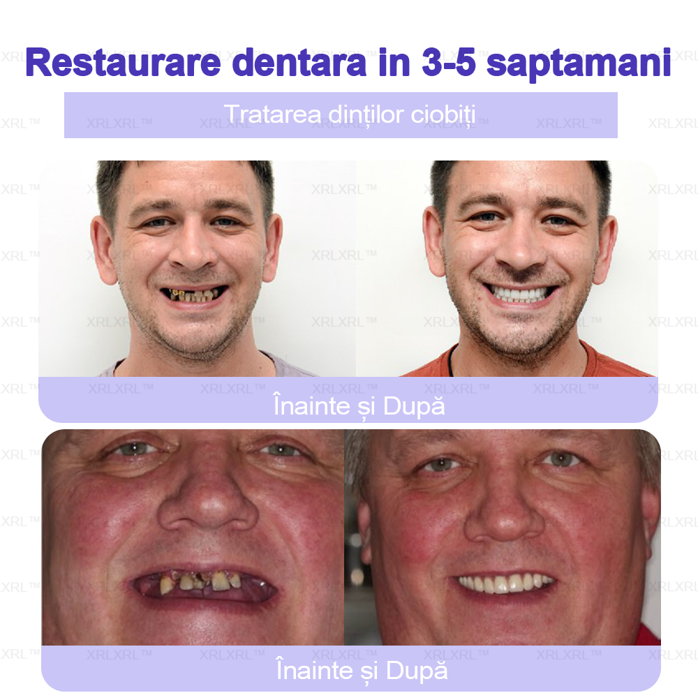 XRLXRL™ Praf Mineral pentru Restaurarea Dentară - Recomandat de ADA (🦷Reducere limitată, mai rămân 30 de minute🦷)